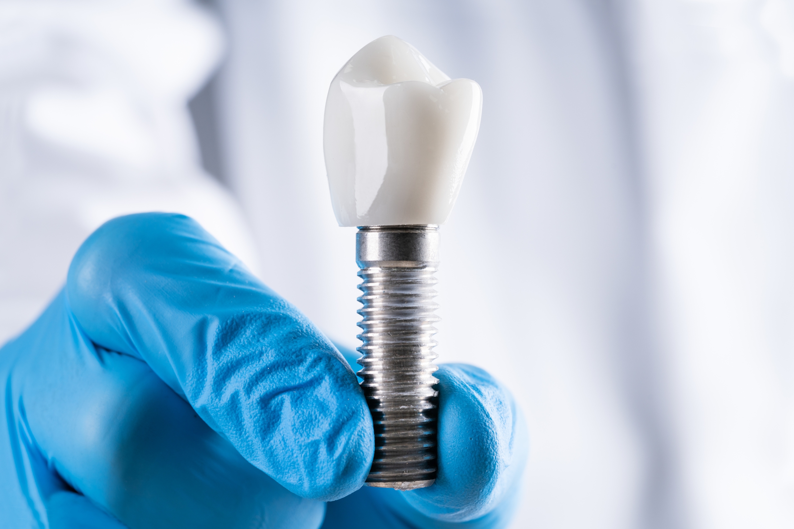 Main Reasons Why People Proceed Abroad For Teeth Implants